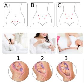 DETEKTOR TĘTNA PŁODU JUMPER JPD-10S6 ZESTAW DO USG