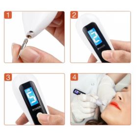 DŁUGOPIS PLAZMOWY DO USUWANIA TATUAŻY ZNAMION PRYSZCZY BIAŁY